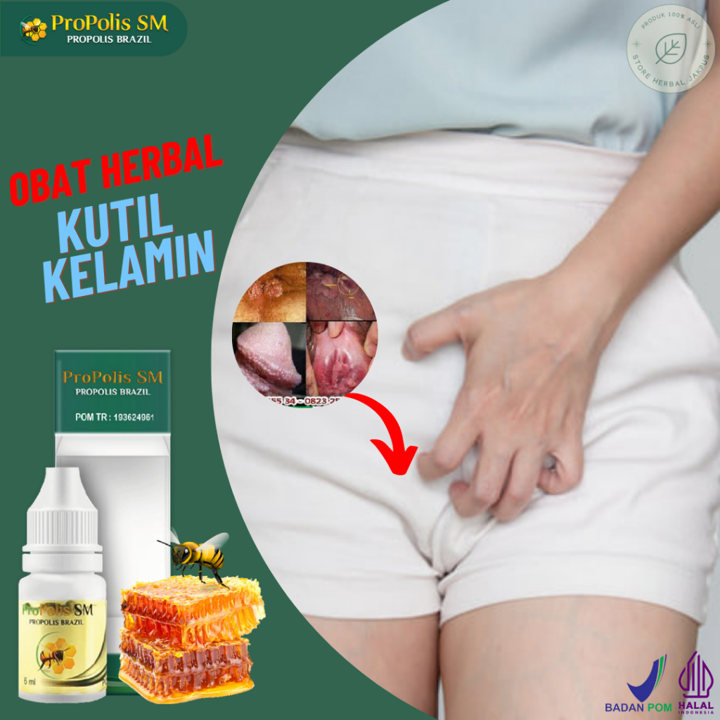 Obat Kutil Kelamin hpv perontok kutil kelamin pria Wanita Obat Penyakit Kutil di Kelamin Pria
