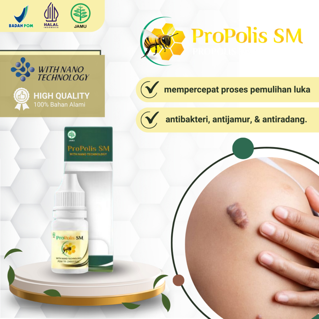 Obat Penghilang Keloid Bekas Luka Operasi Tindik Injeksi, Keloid Menahun, Obat Keloid Daging Tumbuh,