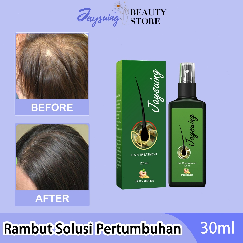 EELHOE rambut Solusi pertumbuhan 30ml/Penumbuh Rambut Botak Dan Rontok / Minyak Rambut / Hair Tonic 