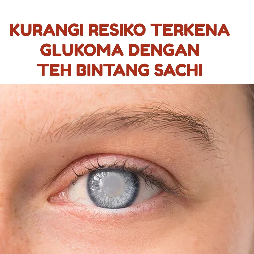 

Jual Herbal Pencegah Glukoma Teh Bintang Sachi