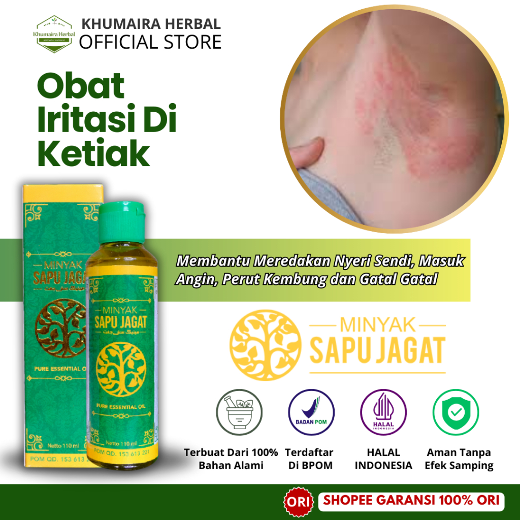 Obat Untuk Iritasi Ketiak, Infeksi Jamur Ketiak Dermatitis, Dermatitis Atopik, Gatal Merah Pada Keti