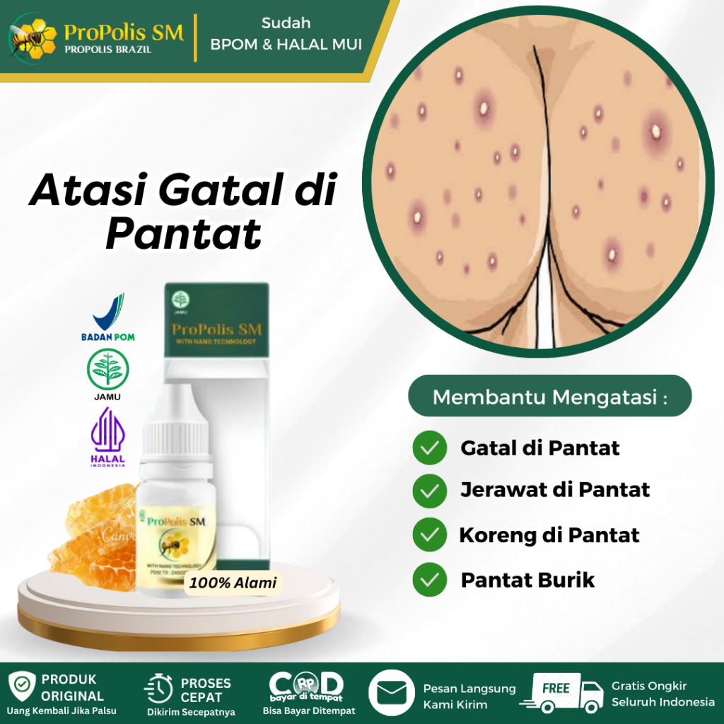 Obat Oles Gatal di Pantat, Koreng di Pantat, Jerawat di Pantat, Pantat Burik, Pantat Hitam, Bekas Lu