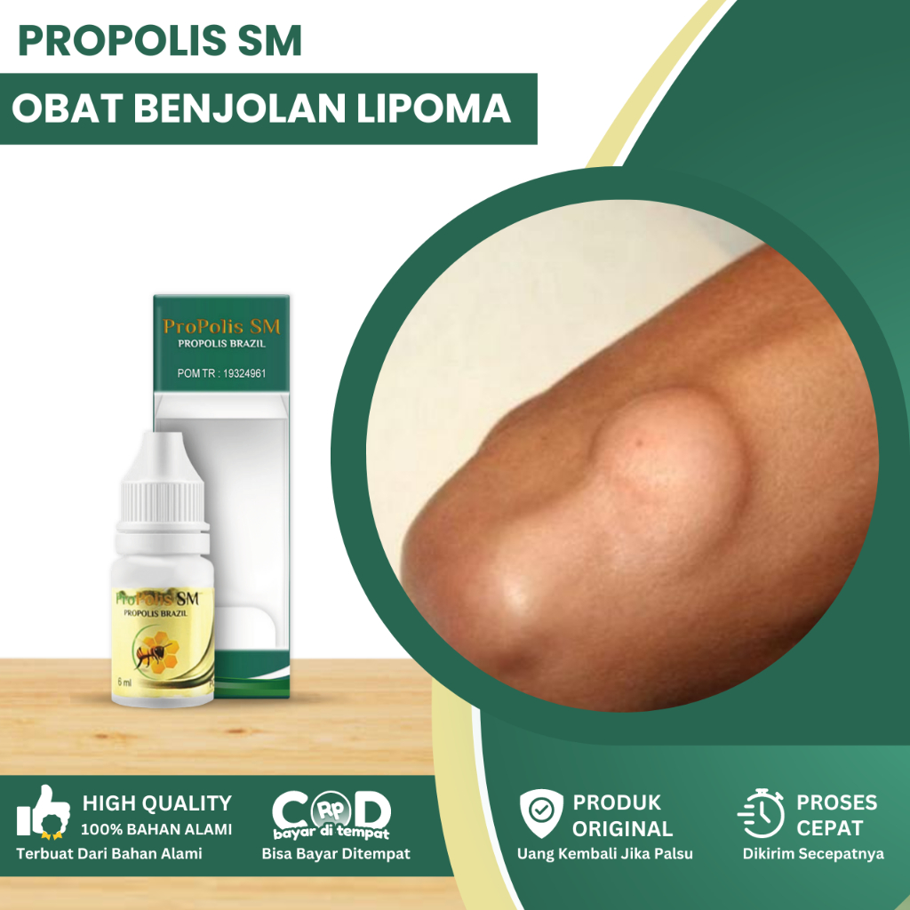 Obat Benjolan Lipoma, Obat Penghancur Benjolan, Obat Penghilang Benjolan, Obat Penghancur Lemak Lipo