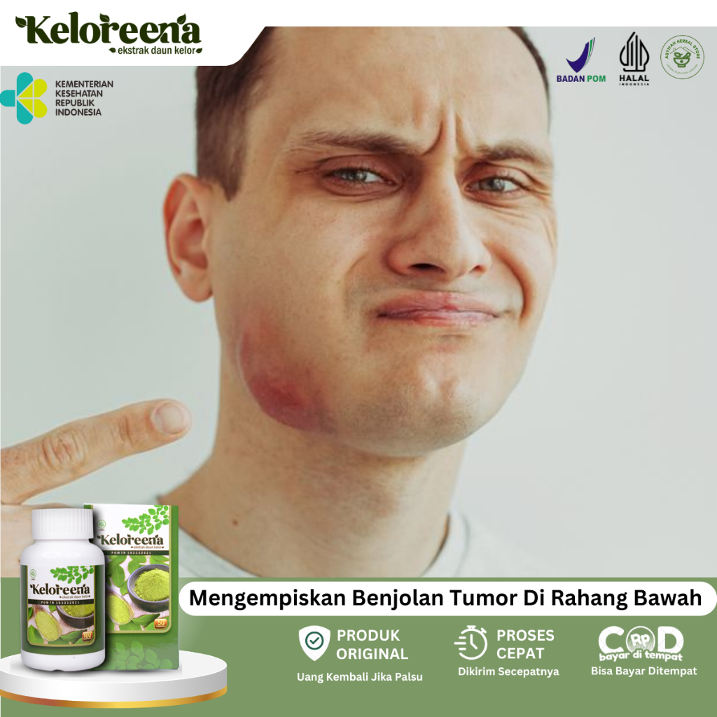 Obat Tumor Rahang, Obat Benjolan Di Bawah Rahang, Oba Kanker Rahang, Obat Benjolan Gusi Di Dalam Mul
