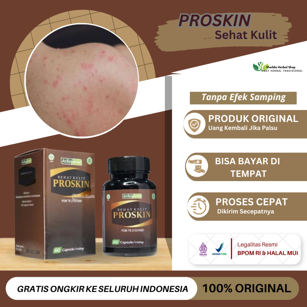 Proskin Gatal Kulit Akibat Biang Keringat, Bintik Merah Biang Keringat Di Punggung, Ruam Bintik Di B