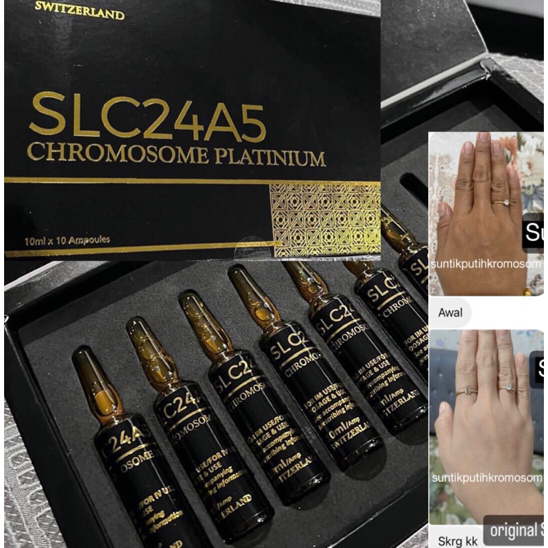 SLC24A5 Chromosome / Suntik putih chromosome / paket infus pemutih / whitening injection