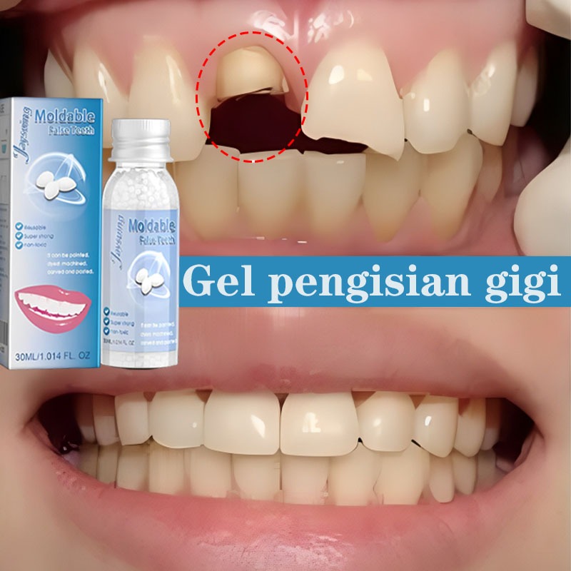 penambal gigi berlubang gigi palsu asli dokter permanen tambal gigi permanen 30ML lem gigi palsu per