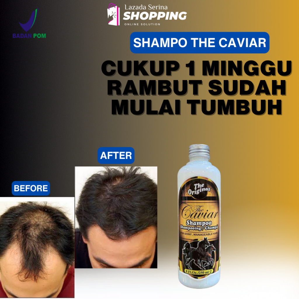 Shampo Kuda Caviar Pemanjang Penumbuh Rambut Original 100% Shampoo Untuk Rambut Rontok BPOM