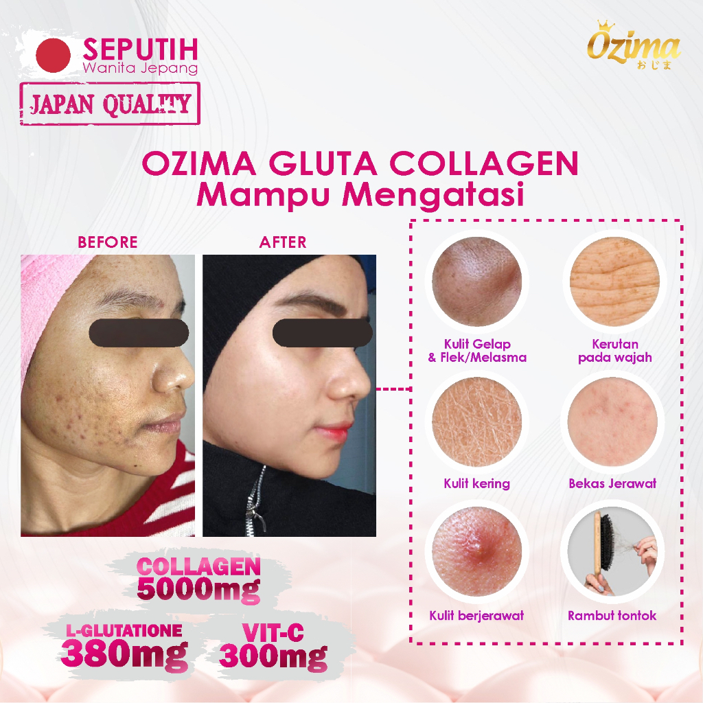 

XMASTER OZIMA GLUTA COLLAGEN DRINK IKAN SALMON COLLAGEN TRIPEPTIDE KOLAGEN DRINK COLLAGEN DNA SALMON