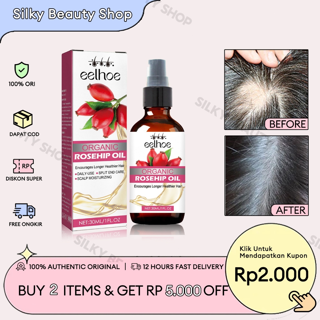 EELHOE Organic Rosehip Oil 30ml Rosehip Hair Oil Anti Rambut Rontok Rosehip Seed Hair Growth Oil