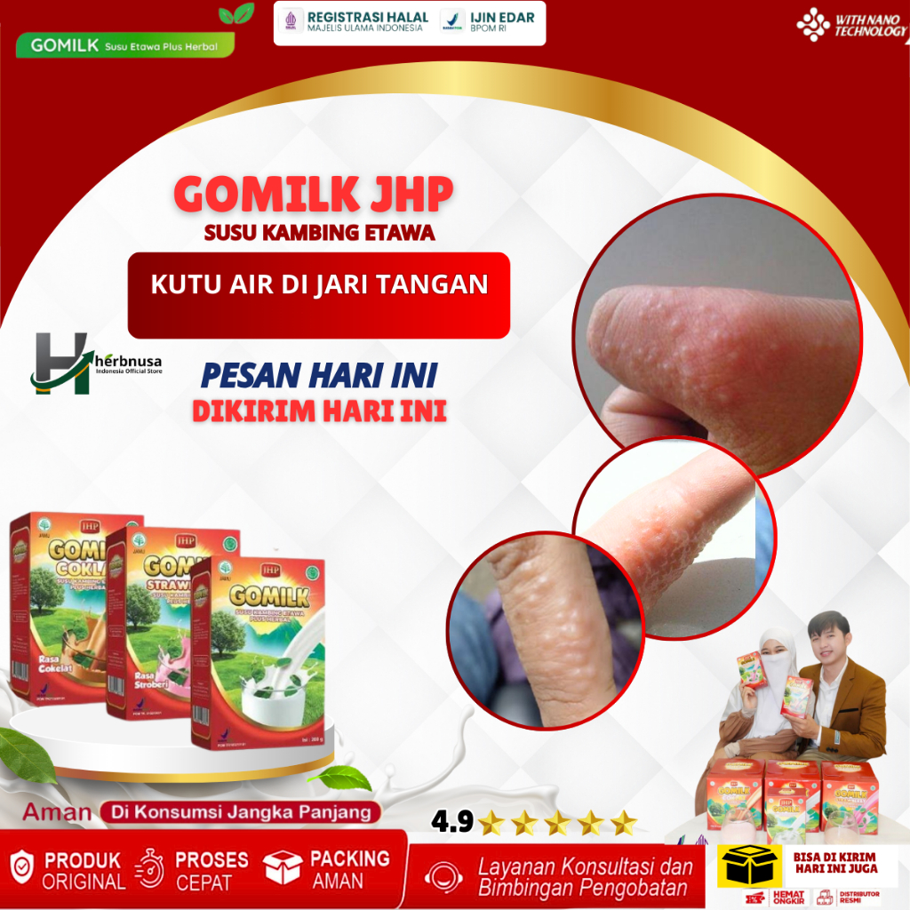 GOMILK JHP Obat Kutu Air Untuk Kaki, Obat Bintik Berair Di Telapak Tangan, Obat Telapak Tangan Gatal