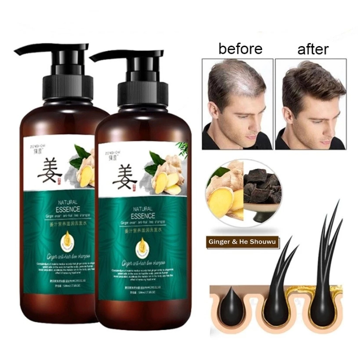 Shampo Penumbuh Rambut Ampuh ( Shampo Rambut Rontok/Botak )