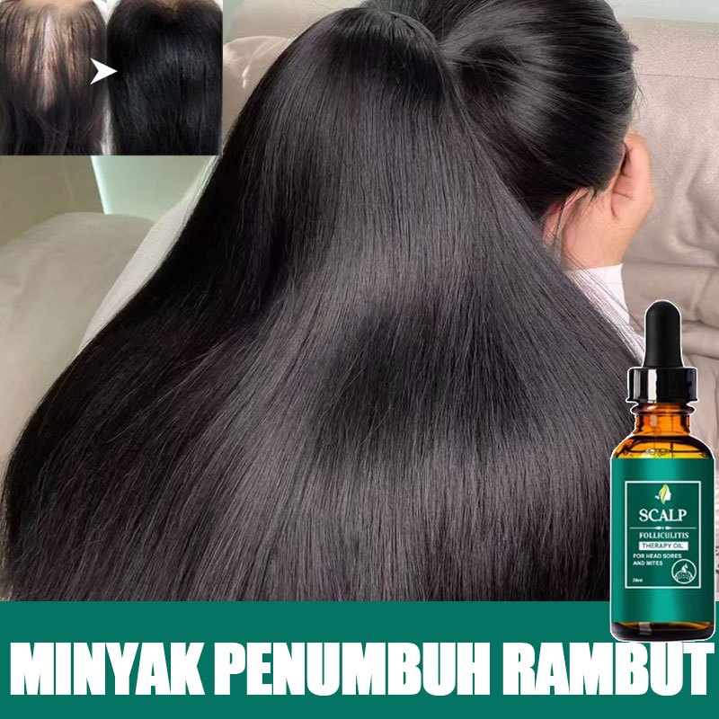 Penumbuh Rambut Botak Minyak Penumbuh Rambut Cepat Dan Tebal Hair Tonic Penumbuh Rambut Vitamin Ramb