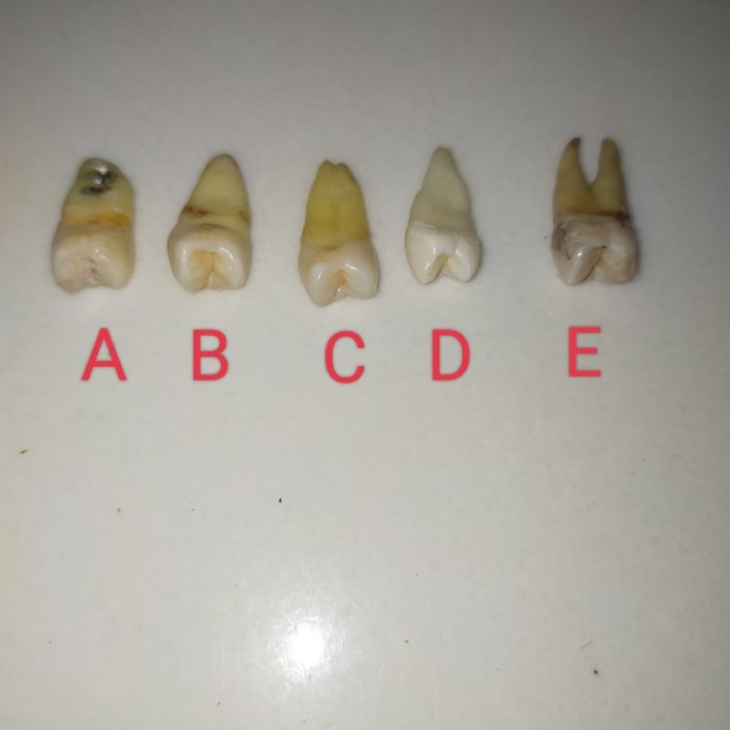 GIGI PRAKTIKUM PREMOLAR ATAS/GIGI ASLI