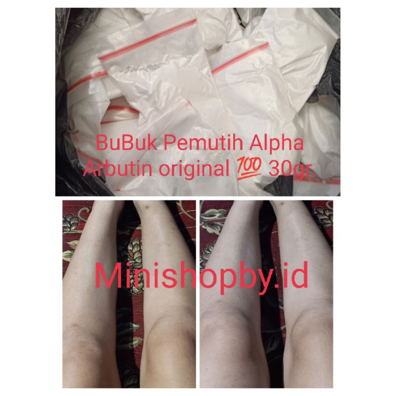 Serbuk Pemutih Dosis Tinggi Alpha Arbutin Ready Makassar