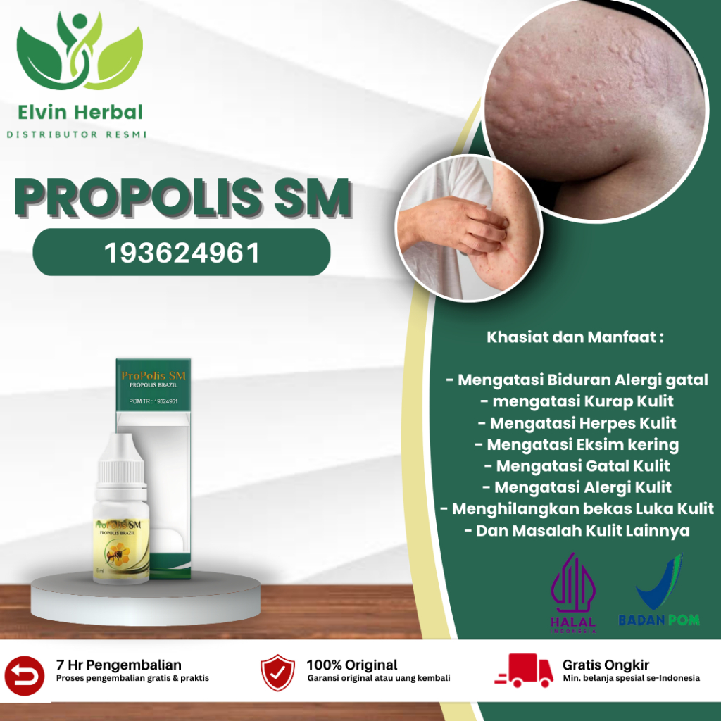 Propolis SM - Obat Biduran, Kaligata, Alergi Gatal Kulit, Alergi Dingin, Biduran Alergi, Biduran Ana