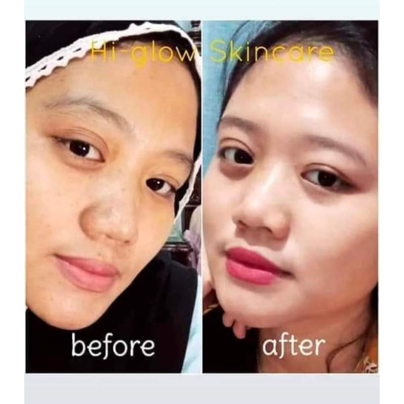 HiGlow skincare