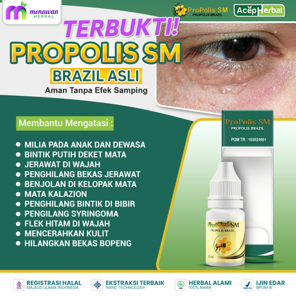 Obat Penghilang Milia diwajah, Obat Milia di bawah Mata, Obat Milia di area mata, Obat Milia di Hidu