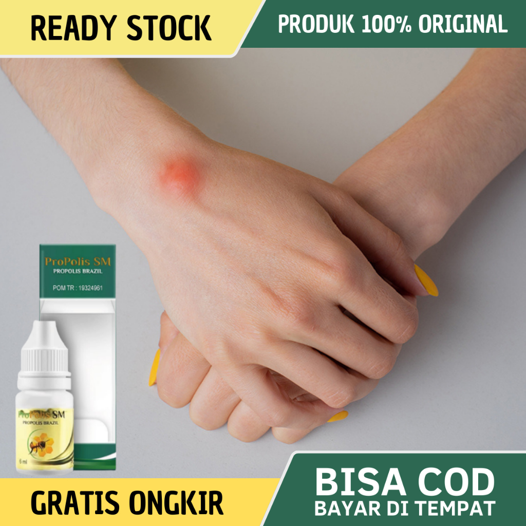 ProPolis SM - Obat Benjolan Di Tangan, Obat Benjolan Pergelangan Tangan, Obat Penghilang Benjolan Di