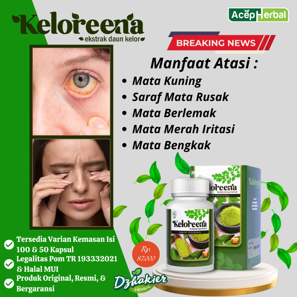Obat Mata Kuning, Saraf Mata Rusak, Mata Berlemak, Mata Merah, Iritasi Mata Atasi Dengan Keloreena K