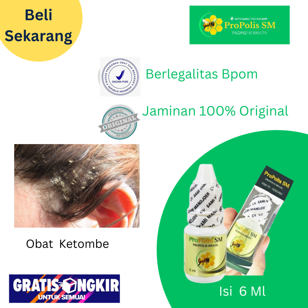 Obat Oles Ketombe Parah Rambut Rontok, Obat Kulit Kepala Gatal, Obat Ketombe Bersisik Berkerak, Sale