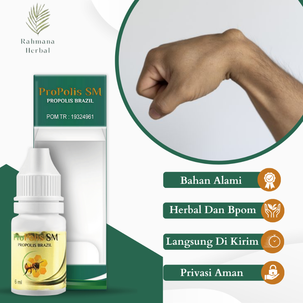 Obat Benjolan Di Tangan Obat Kista Ganglion Obat Benjolan Di Tangan Obat Benjolan Di pergelangan Tan