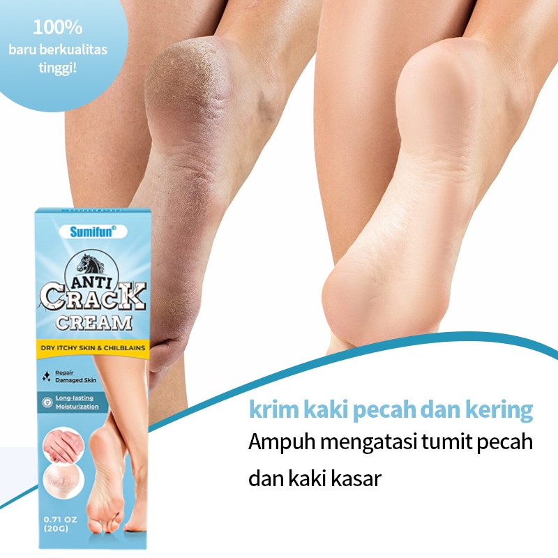 EL852 Krim kaki pecah dan kering salep kaki pecah dan kering ampuh perawatan kaki pecah dan kering