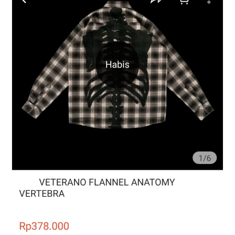 EXERLIE ANATOMY VERTEBRA