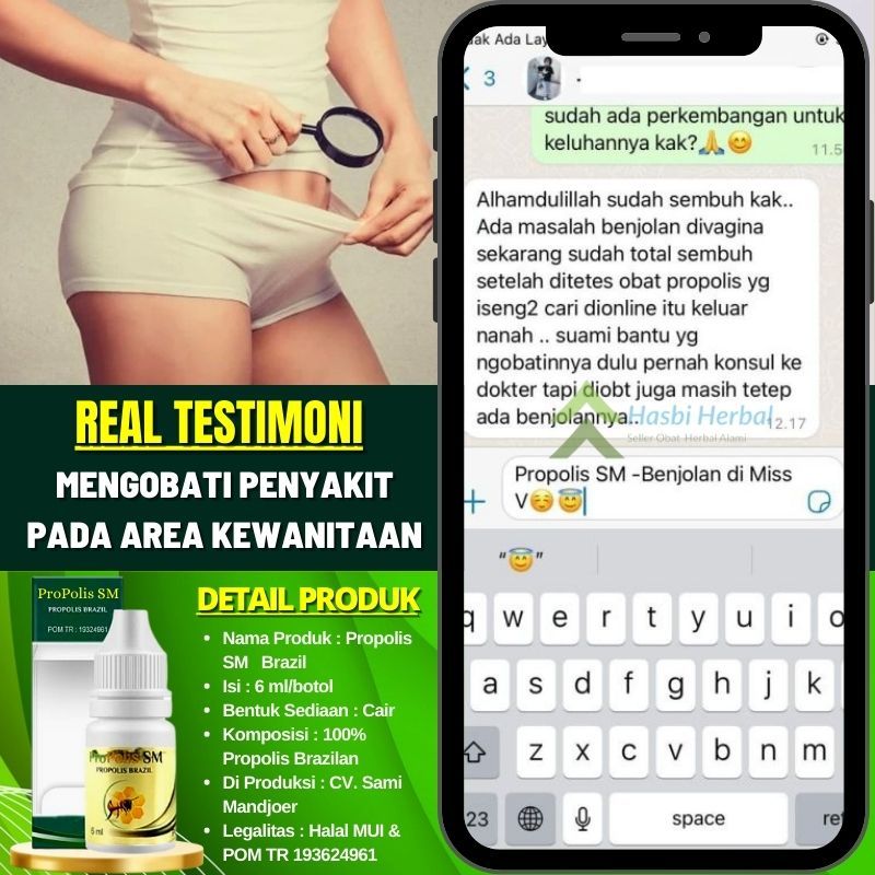 Salep Alami Kista Vagina / Benjolan di Dalam Vagina, Benjolan di Bibir Vagina, Benjolan di Luar Vagi