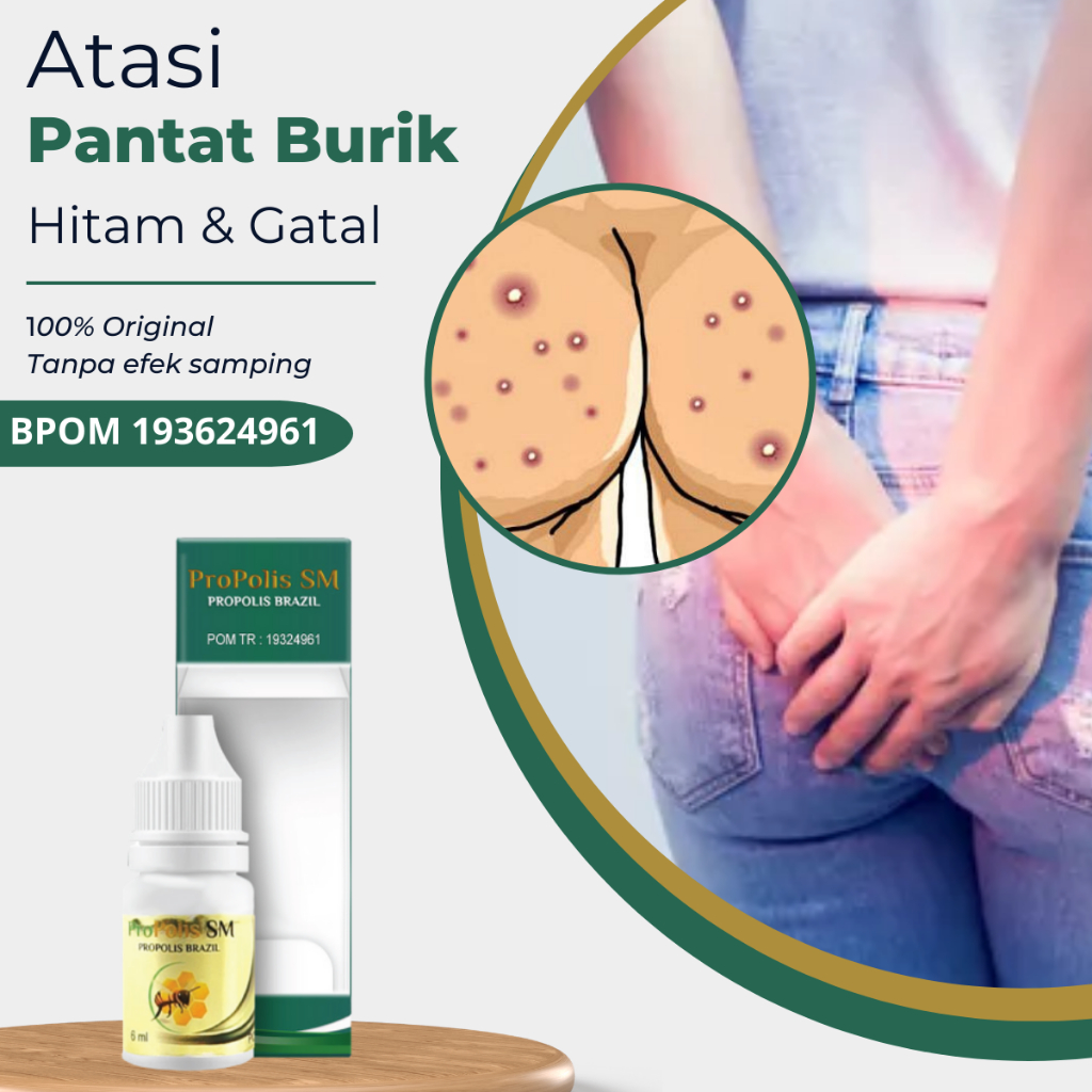 Obat Pantat Burik, Obat Gatal Bokong dan Hitam, Obat Pantat Bruntusan, Obat Pantat Burik, Obat Gatal