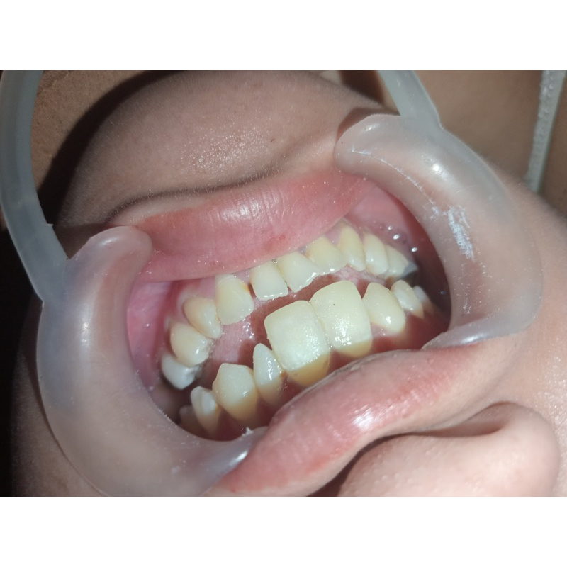 Gigi Kelinci By Edelweiss