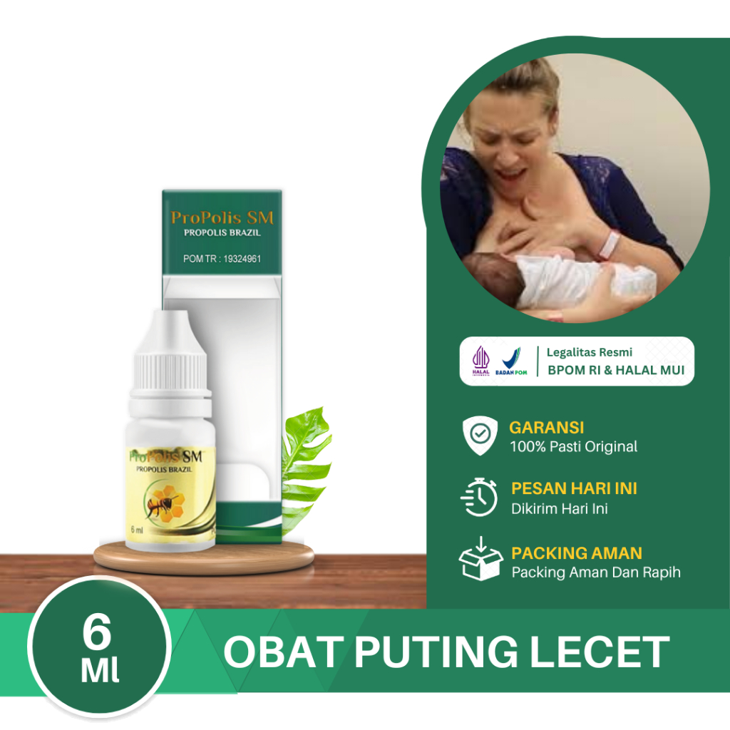 Obat Puting Lecet, Puting Susu Luka, Infeksi Jamur Payudara, Puting Lecet Saat Menyusui, Iritasi Aki