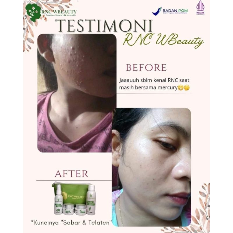 RNC GLOW // RNC SKINCARE // SKINCARE RNC GLOW