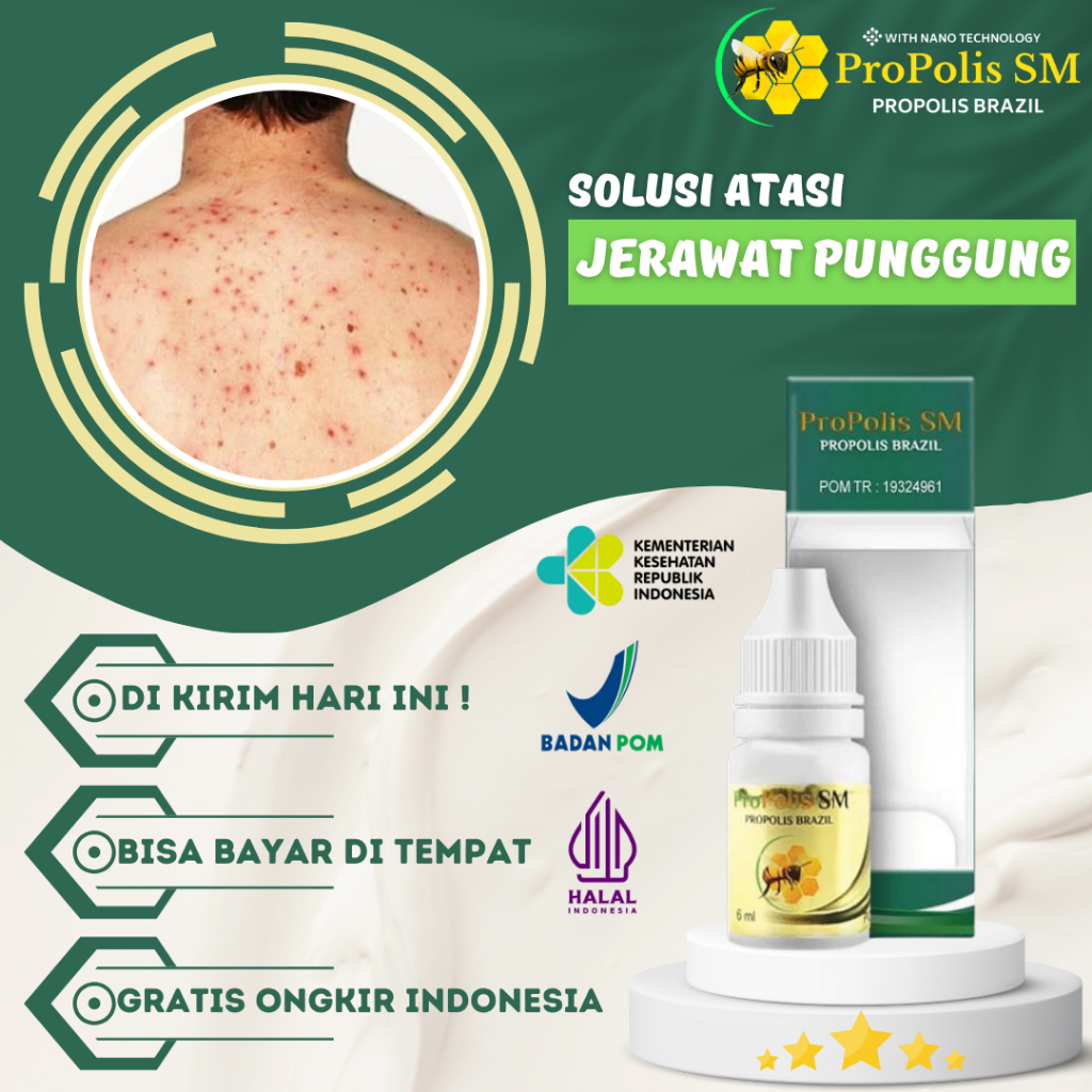 Obat Jerawat punggung, Penghilang Jerawat Punggung, Salep Jerawat punggung, Obat jerawat badan, Obat