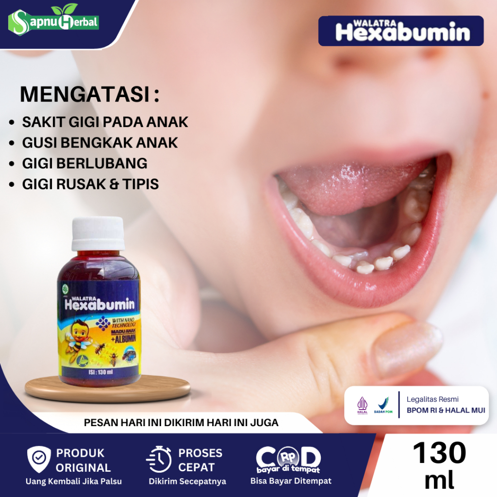 Obat Sakit Gigi Anak, Sakit Gigi Berlubang, Gusi Bengkak Anak Balita, Penumbuh Gigi Anak, Vitamin Un