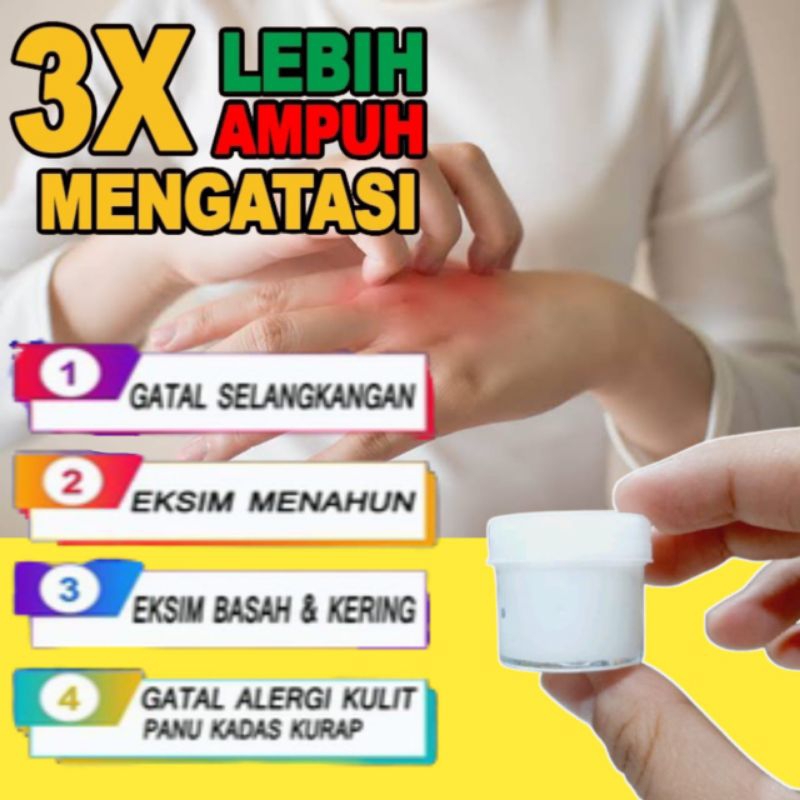 Salep Gatal untuk kulit paling ampuh