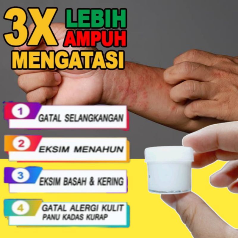 Salep paling ampuh untuk Gatal racikan apotek