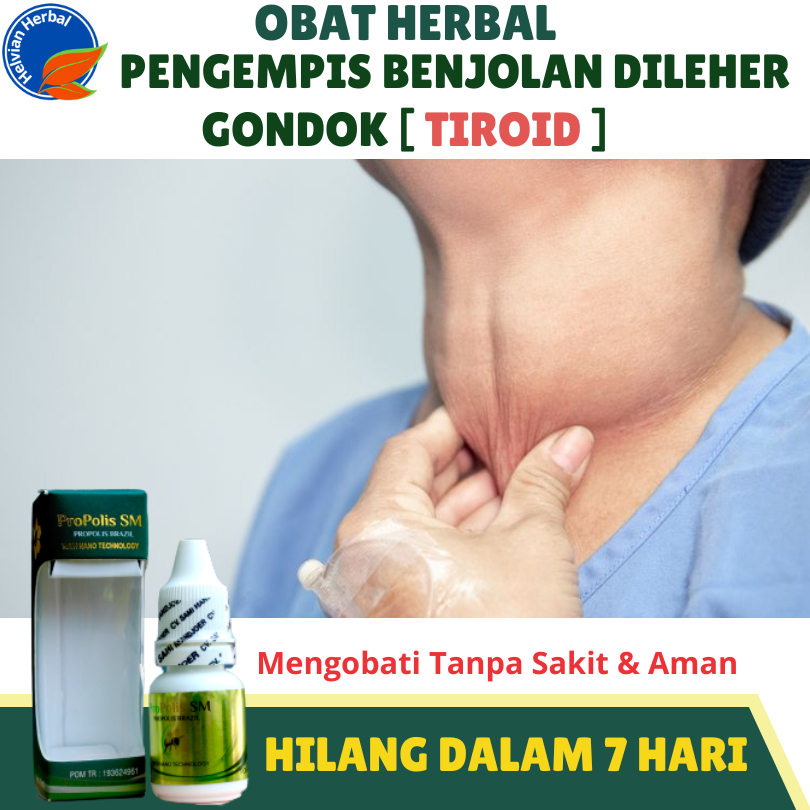 Obat Oles Tiroid Gondok, Kelenjar Tiroid, Gondokan Pengmpis Gondok Propolis SM  - Pake Herbal