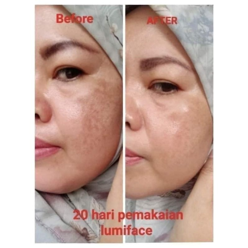 Lumiface beauty mask mci original 100%