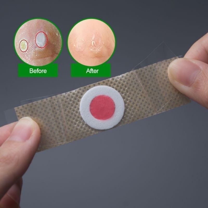 Plester kutil mata ikan Corn Removal satuan