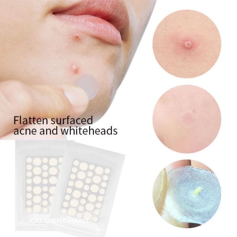 Acne patch super plaster