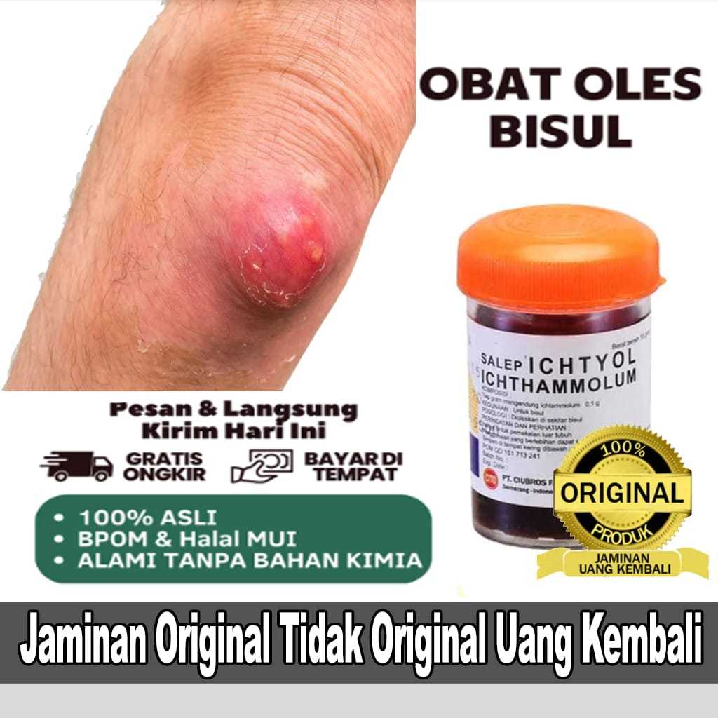 OBAT BISUL ASLI SALEP HITAM ICHTIOL KRIM CINA UNTUK ATASI JERAWAT BISULAN EKSIM GATAL SELANGKANGAN