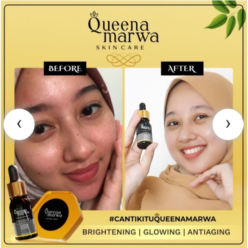 QUEENA MARWA SKINCARE