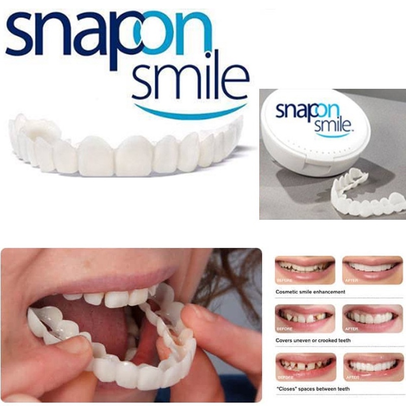 Snap On Smile Gigi Palsu 1 Set Atas Bawah - Gigi Palsu Silikon