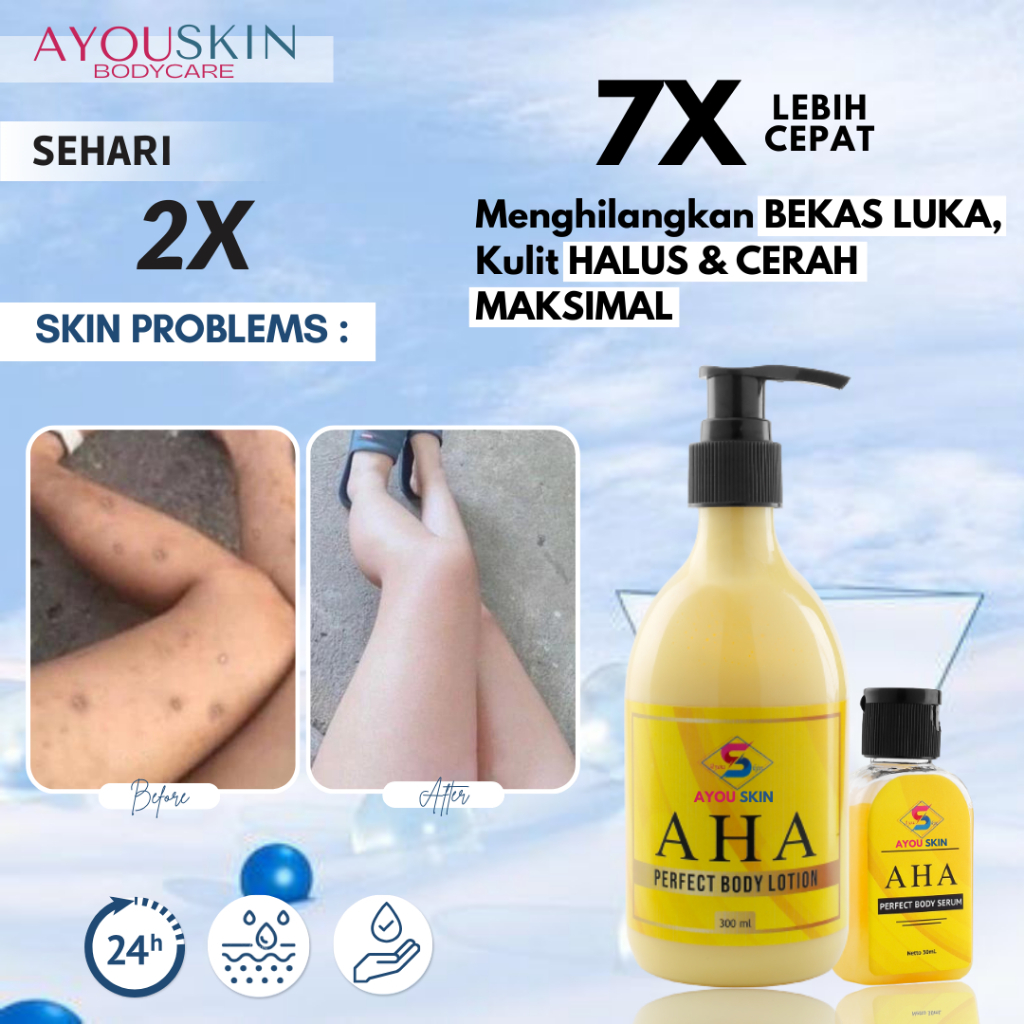 Penghilang Bekas Luka Korengan Cream Penghilang Bekas Luka Korengan, BODY LOTION Penghilang Bekas Lu