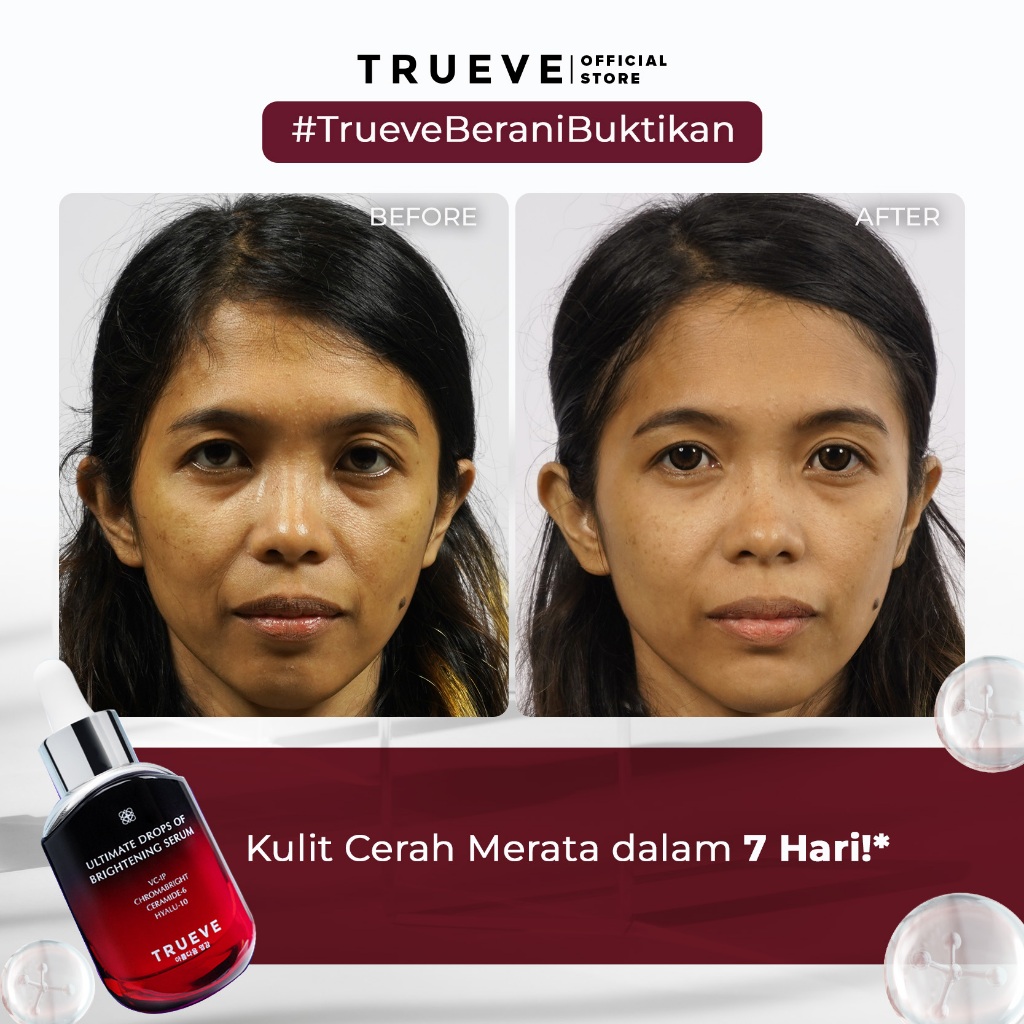 Trueve Paket Glowing Anti Jerawat (Acne Care Treatment Serum &amp; Ultimate Drops of Brightening Serum)