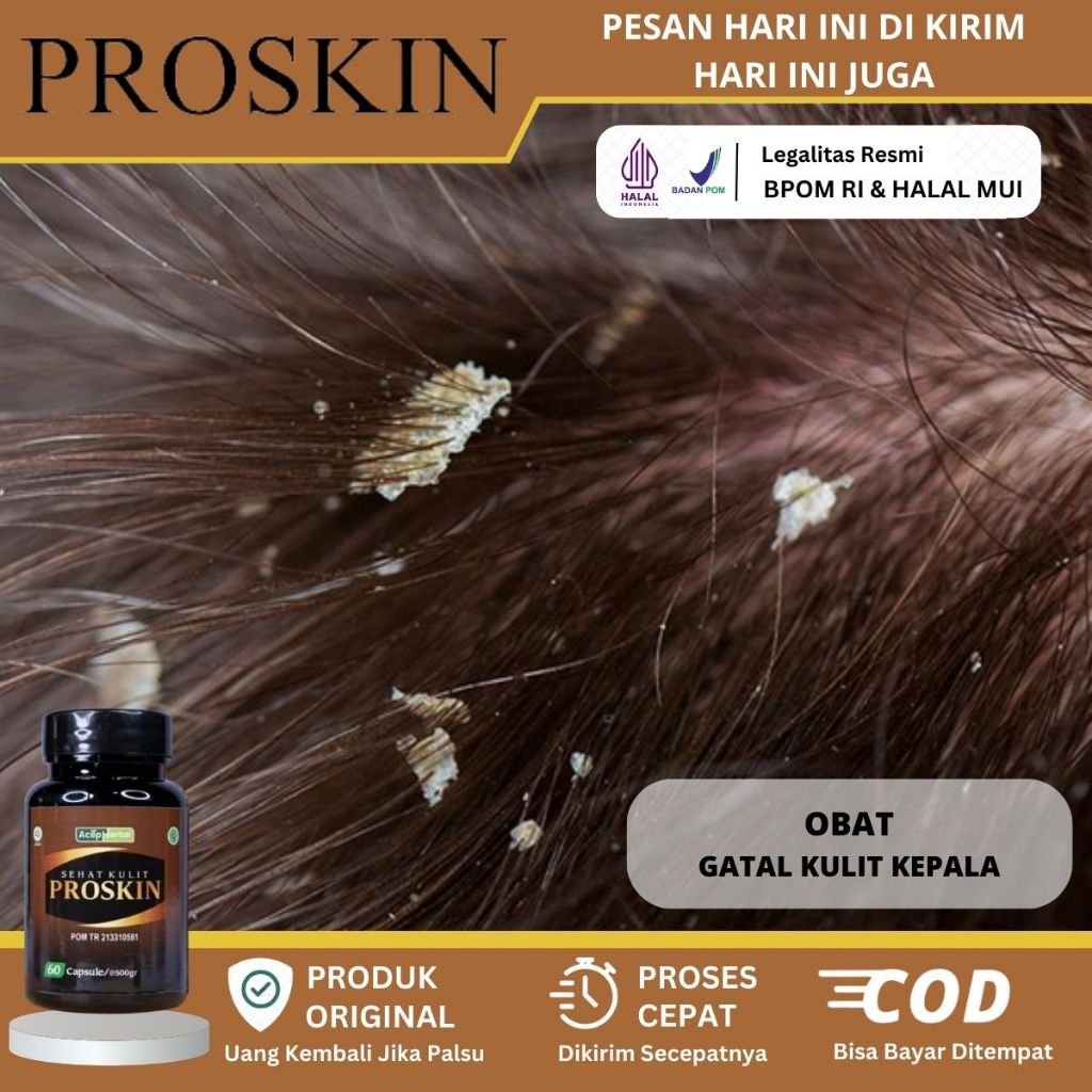 Obat Gatal Kulit Kepala, Obat Jamur Kulit Kepala, Obat Kulit Kepala Gatal, Obat Pembersih Borok Di K