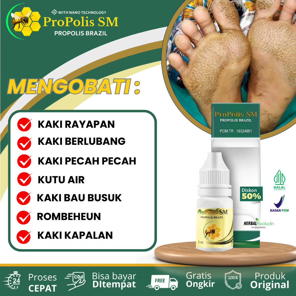 Obat Tetes Oles Kaki Rayapan, Obat Kaki Berlubang, Obat Telapak Kaki Bolong Bolong Kecil, Obat Kaki 