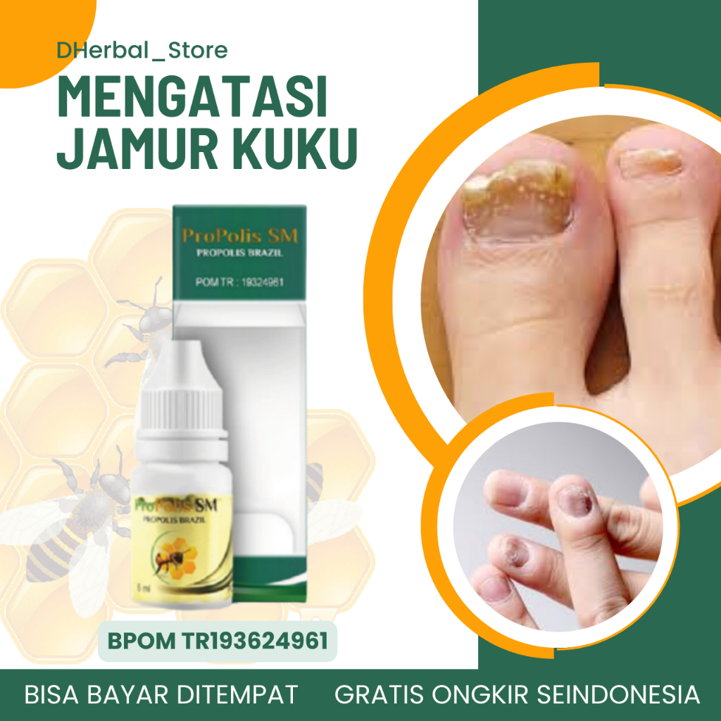 Obat Jamur Kuku, Obat Kuku Rusak, Obat Kuku Kuning, Obat Kuku Psoriasis, Obat Kuku Menguning, Obat I