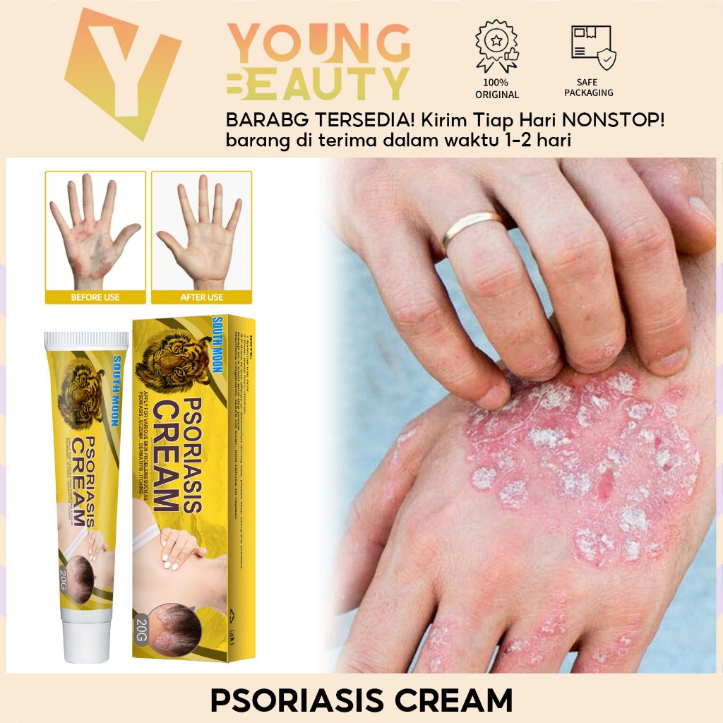 South Moon Tiger Psoriasis Cream Chinese herbal medicine tiger label paste itching psoriasis ointmen